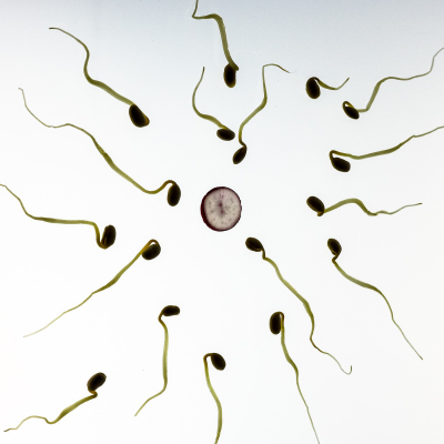 Spermien (Image by TBIT (CC0 Public Domain)via Pixabay)