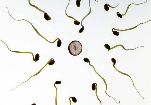 Spermien (Image by TBIT (CC0 Public Domain)via Pixabay)