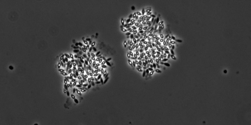 Bacterial Spores (adapted)(Image by adonofrio [CC BY 2.0], via flickr)