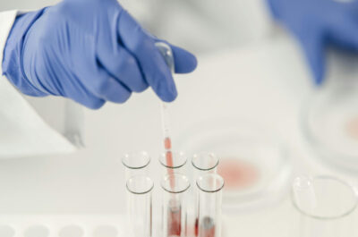 Im Vordergrund ist eine Hand mit Gummihandschuh zu sehen, die mit einer Pipette Flüssigkeit aus einem Reagenzglas entnimmt. Im Hintergrund sind Petrischalen zu sehen.