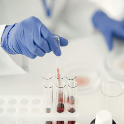 Im Vordergrund ist eine Hand mit Gummihandschuh zu sehen, die mit einer Pipette Flüssigkeit aus einem Reagenzglas entnimmt. Im Hintergrund sind Petrischalen zu sehen.