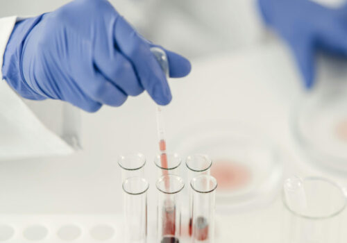 Im Vordergrund ist eine Hand mit Gummihandschuh zu sehen, die mit einer Pipette Flüssigkeit aus einem Reagenzglas entnimmt. Im Hintergrund sind Petrischalen zu sehen.