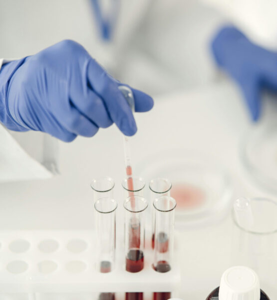 Im Vordergrund ist eine Hand mit Gummihandschuh zu sehen, die mit einer Pipette Flüssigkeit aus einem Reagenzglas entnimmt. Im Hintergrund sind Petrischalen zu sehen.